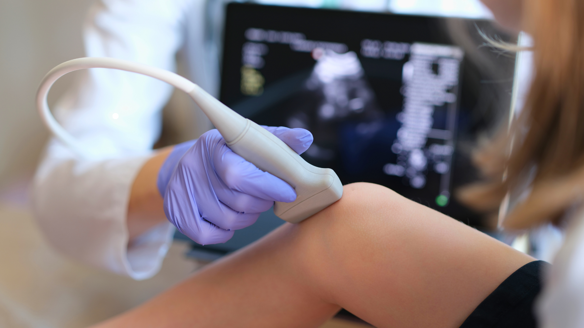 healthcare professional performing ultrasound on patient knee