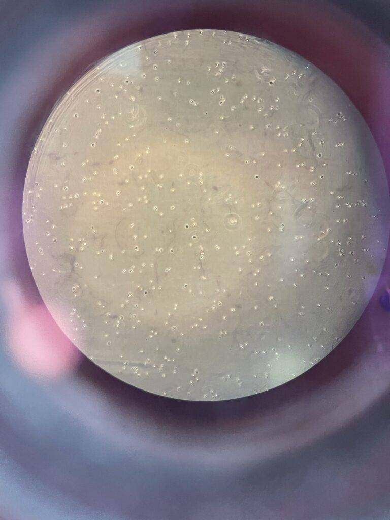 cells viewed in a microscope